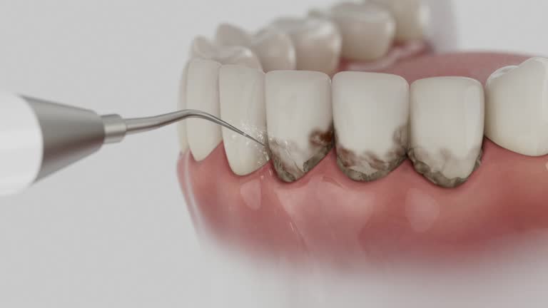 Trusted Dental Crowns And Bridges service in Charlestown, IN - Dentist Open Now